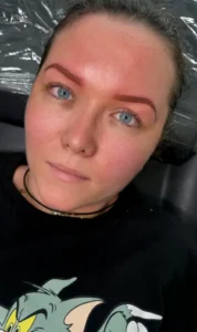 Formation Browlift - Rehaussement de Sourcils